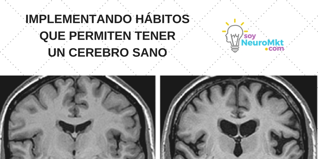 Implementando Hábitos que Permiten Tener un Cerebro Sano